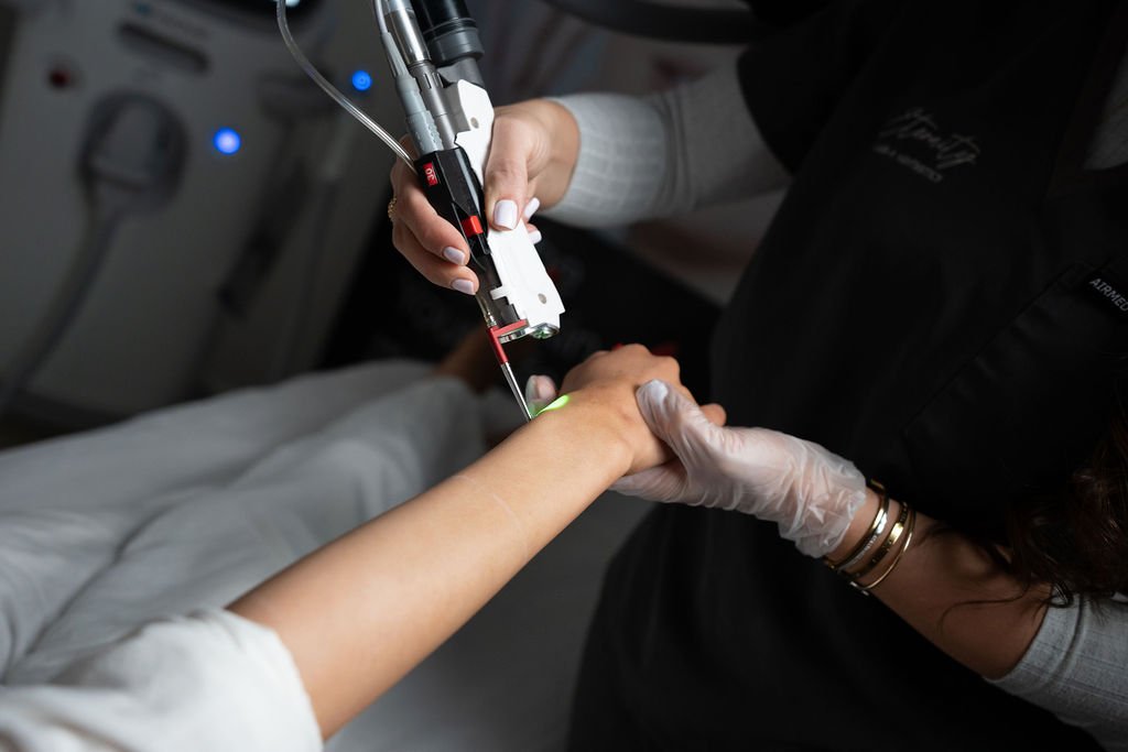 DEKA laser hair removal at Eternity Laser Dural